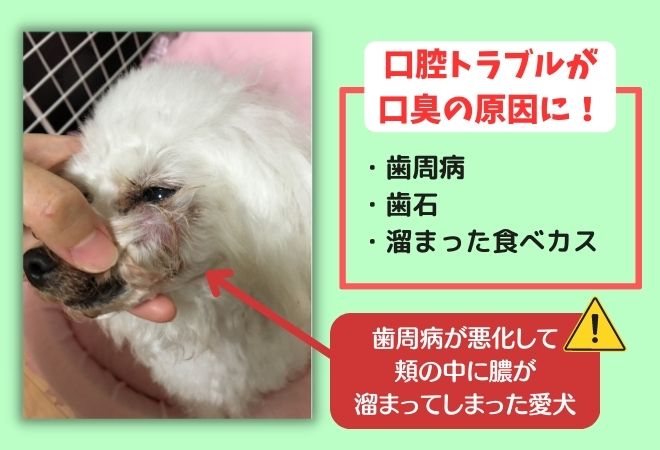 口臭の原因として最も多い口腔トラブル、歯周病